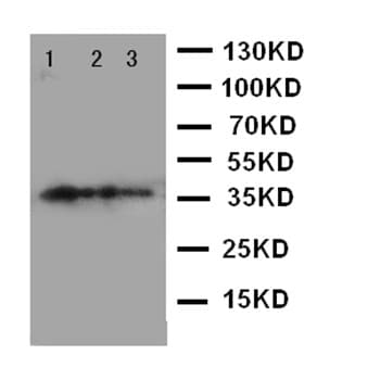 Mbd4 Med1 Antibody C Terminal Ab191037  Western Blot Img43236