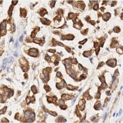 Anti-COX2 / Cyclooxygenase 2 antibody [SP21](AB16701)