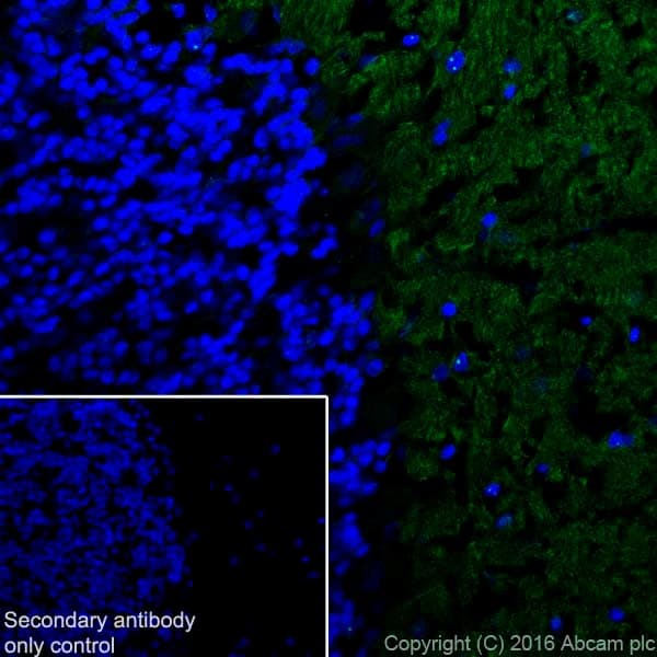Anti-Tenascin C antibody [EPR4219](AB108930)