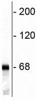 68kda Neurofilament Nf L Antibody Ab72997  Western Blot Img105614