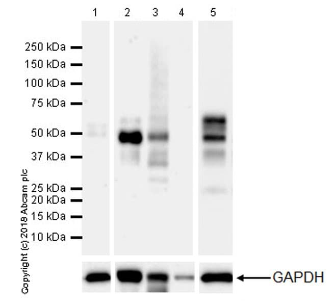 Anti-4R Tau antibody [EPR21725](ab218314)