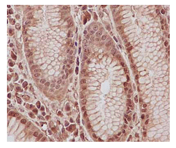 Psme2 Antibody Epr14931 Bsa And Azide Free Ab250700  Immunohistochemistry Formalin Pfa Fixed Paraffin Embedded Sections Img136972