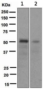 Anti-FOXA2 antibody [EPR4466](AB108422)