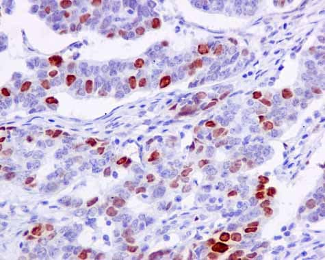 Nucleolin Phospho T76 Antibody Epr8080 2 Ab168363  Immunohistochemistry Formalin Pfa Fixed Paraffin Embedded Sections Img19931