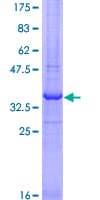 Recombinant Human RNF121 protein(AB163056)