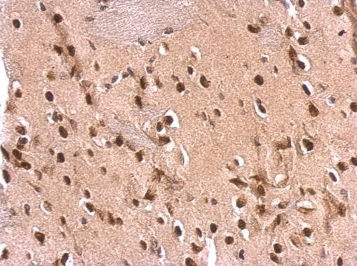 Ets2 Antibody Ab272866  Immunohistochemistry Formalin Pfa Fixed Paraffin Embedded Sections Img78291