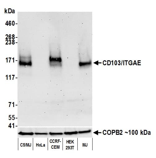 Anti-CD103/ITGAE antibody [BLR171J] - BSA free(AB314101)