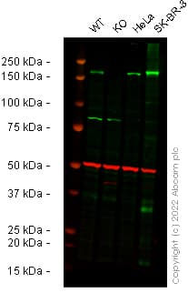 Anti-ErbB2 / HER2 antibody [EP1045Y](AB134182)