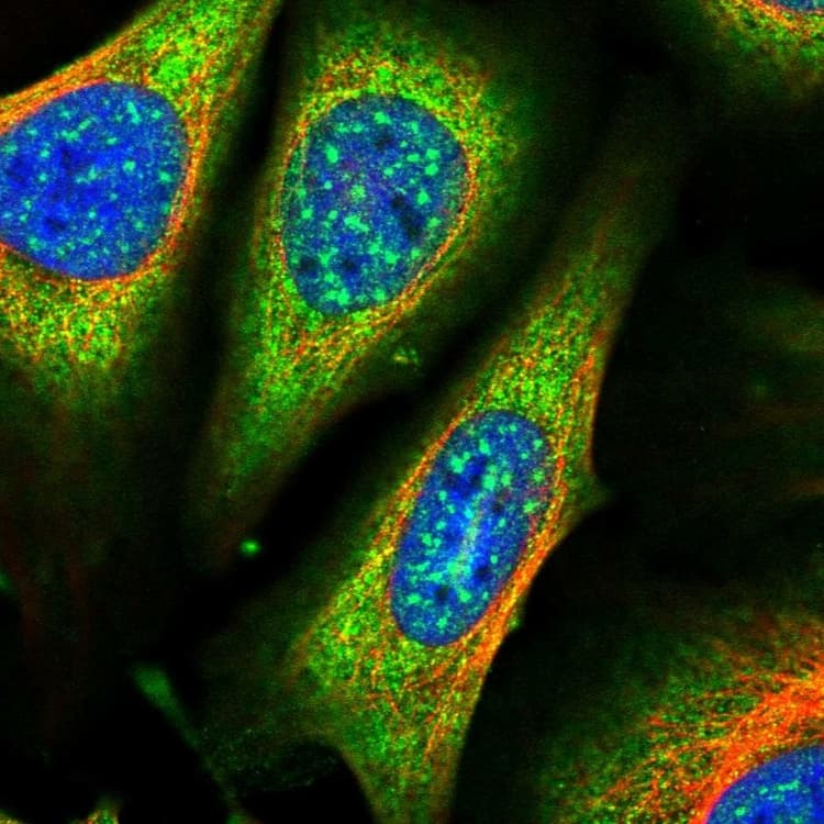 Arhgap18 Antibody Ab262926  Immunocytochemistry Immunofluorescence Img107792