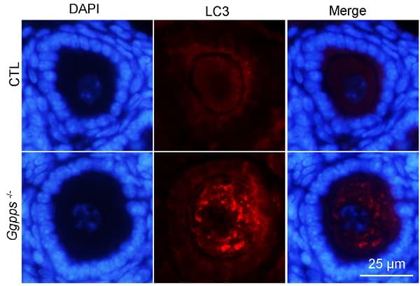 Anti-LC3B antibody - Autophagosome Marker(AB48394)