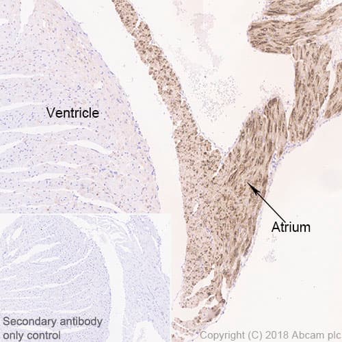 Bnp Antibody Epr22339 65 Bsa And Azide Free Ab243857  Immunohistochemistry Formalin Pfa Fixed Paraffin Embedded Sections Img73780