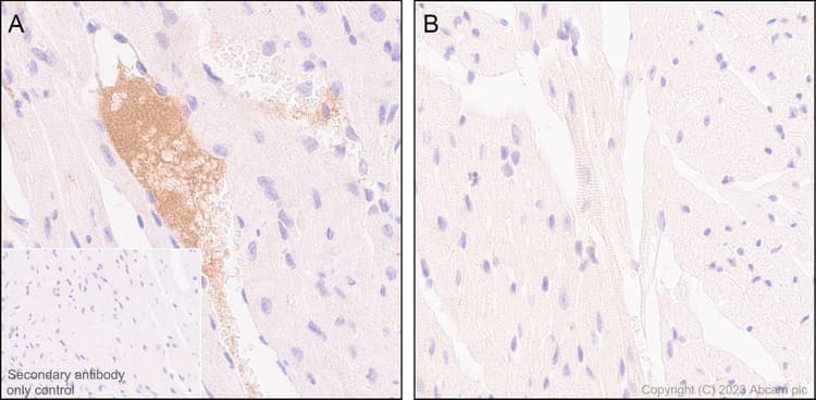 Anti-Apolipoprotein B-100 antibody [EPR19946-175](AB315265)