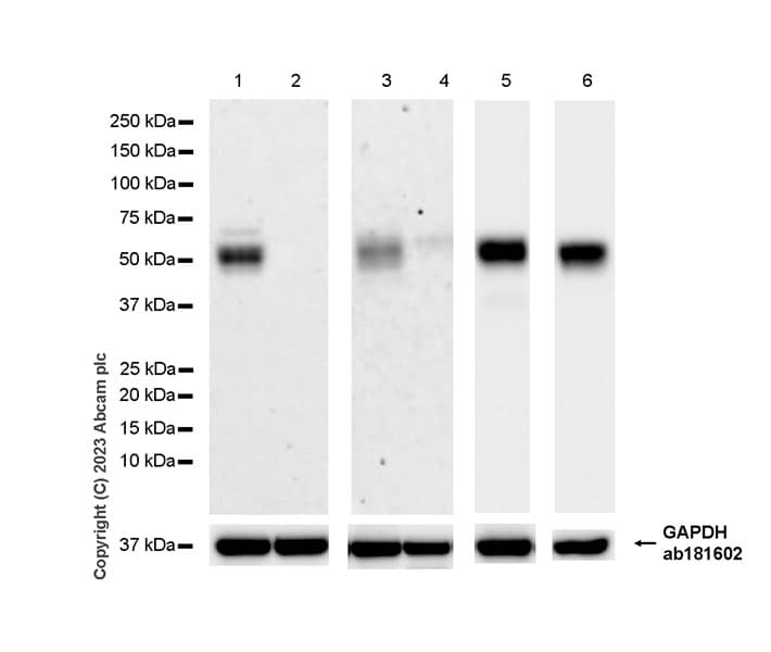 Cd1d Antibody Epr28086 36 Ab314132  Western Blot Img420249