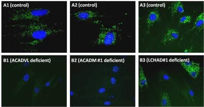 Human Fatty Acid Oxidation In-Cell ELISA Kit(AB118182)