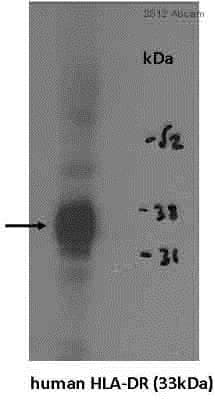 Anti-HLA-DR antibody [TAL 1B5](AB20181)