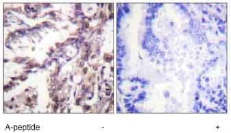 P53 Acetyl K381 Antibody Ab61241  Immunohistochemistry Formalin Pfa Fixed Paraffin Embedded Sections Img60460