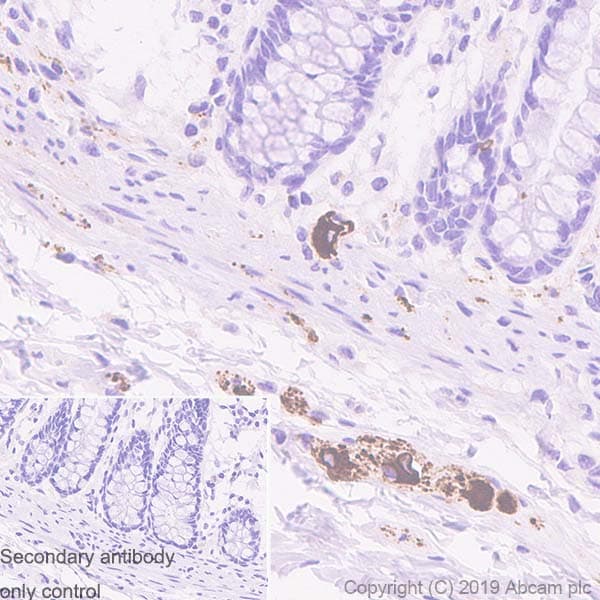 Anti-Peripherin antibody [EPR23445-28] - BSA and Azide free(AB269861)