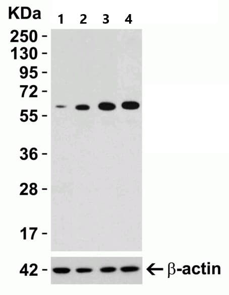 Anti-SQSTM1 / p62 antibody(AB91526)