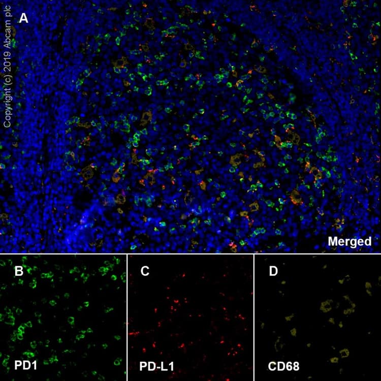 Anti-CD68 antibody [EPR20545](AB213363)