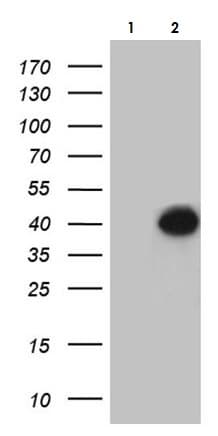 Cd161 Antibody Oti1d8 Bsa And Azide Free Ab273666  Western Blot Img54499