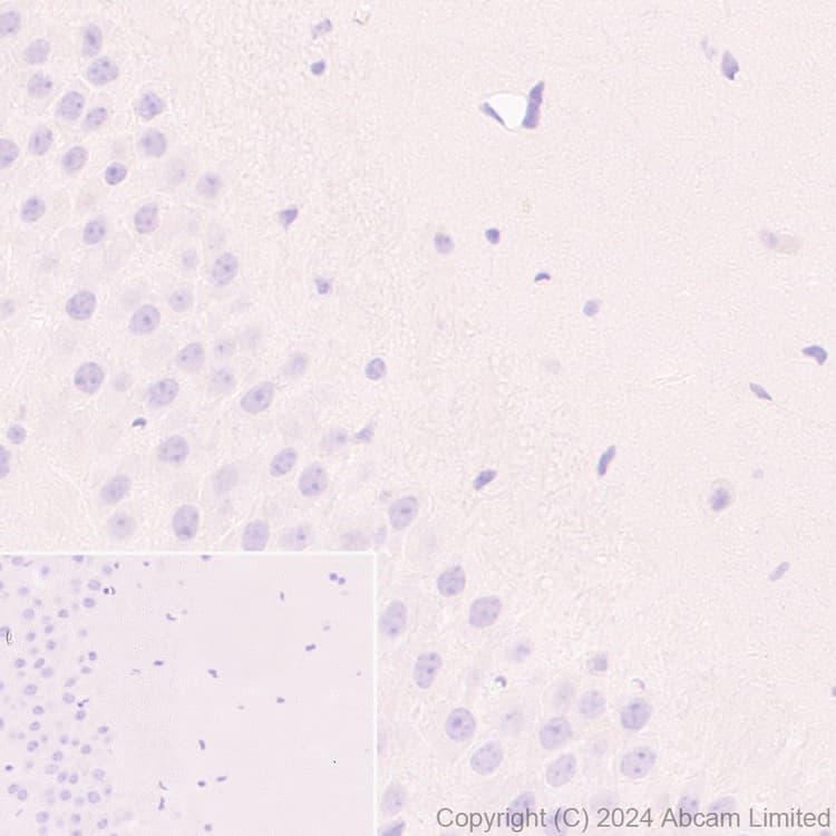 Alkaline Phosphatase Antibody Epr20428 147 Bsa And Azide Free Capture Ab252581  Immunohistochemistry Formalin Pfa Fixed Paraffin Embedded Sections Img440869