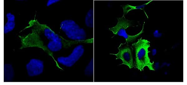 Anti-DDDDK tag (Binds to FLAG® tag sequence) antibody(AB1162)