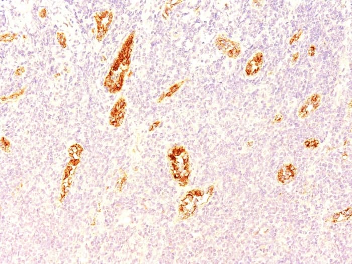 Von Willebrand Factor Antibody 3e2d10 Ab194405  Immunohistochemistry Formalin Pfa Fixed Paraffin Embedded Sections Img33061