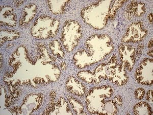 Slc45a3 Antibody Epr47952 Bsa And Azide Free Ab242056  Immunohistochemistry Formalin Pfa Fixed Paraffin Embedded Sections Img136989