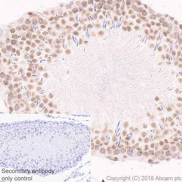Rad50 Antibody Epr20968 Bsa And Azide Free Ab236460  Immunohistochemistry Formalin Pfa Fixed Paraffin Embedded Sections Img12191