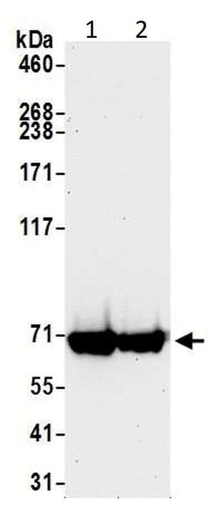 Anti-CARM1 antibody(AB245467)