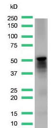 Anti-Desmin antibody [SP138] - C-terminal(AB227651)