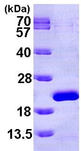 Ab101058  Sds Page Img34837