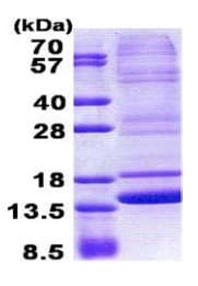 Recombinant Human Neuromedin B protein (denatured)(AB167850)