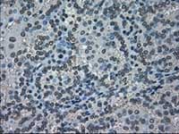 Anti-NEK6 antibody [OTI2H7](AB117986)