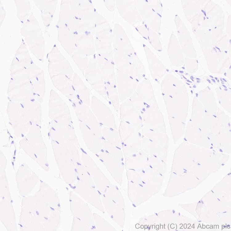Lox 1 Antibody Epr27871 67 Bsa And Azide Free Ab317690  Immunohistochemistry Formalin Pfa Fixed Paraffin Embedded Sections Img432111