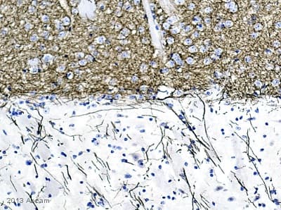 Anti-Tyrosine Hydroxylase antibody [EP1532Y] - Neuronal Marker(AB137869)