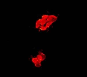Lin28a Antibody Epr4640 Bsa And Azide Free Ab226089  Immunocytochemistry Immunofluorescence Img967