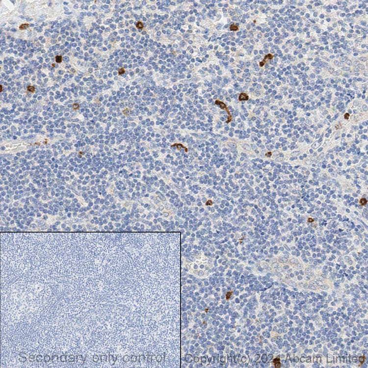 Anti-CD63 antibody [EPR5702] - Late Endosome Marker(AB134045)