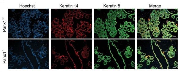 Anti-Cytokeratin 8 antibody [EP1628Y] - Cytoskeleton Marker(AB53280)