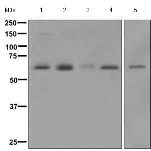 Syvn1 Hrd1 Antibody Ep7459 Bsa And Azide Free Ab249578  Western Blot Img101645