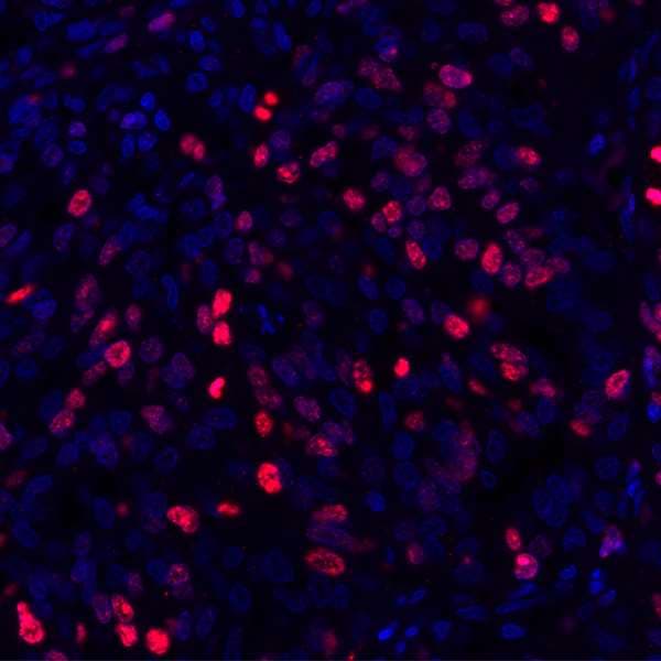 Ki67 Antibody Blr021e Ab243878  Immunohistochemistry Formalin Pfa Fixed Paraffin Embedded Sections Img174844