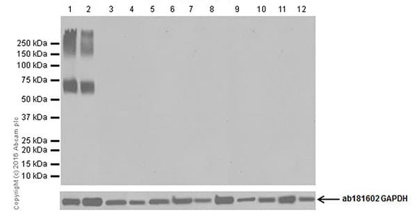 Anti-EAAT2 antibody [EPR19794](AB205247)