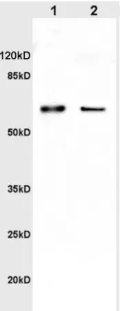 Anti-Catalase antibody(AB217793)
