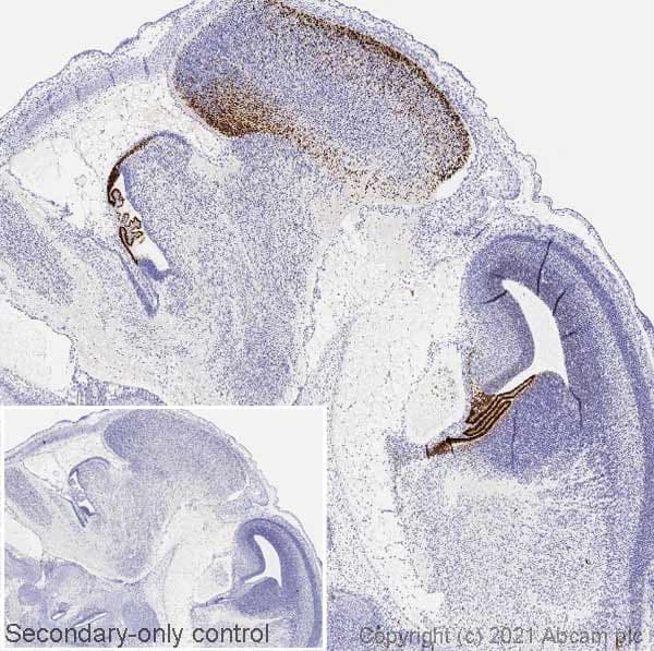 Anti-Otx2 antibody [EPR20375](AB183951)