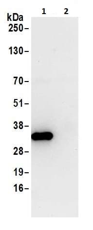Anti-HPRT antibody(ab226412)