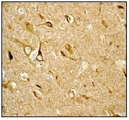 Prkar2b Antibody Ep2648 Bsa And Azide Free Ab284731  Immunohistochemistry Formalin Pfa Fixed Paraffin Embedded Sections Img112717
