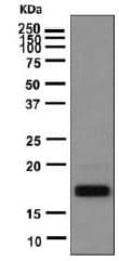 Tsh Beta Antibody Epr8198 Bsa And Azide Free Ab249213  Western Blot Img42848