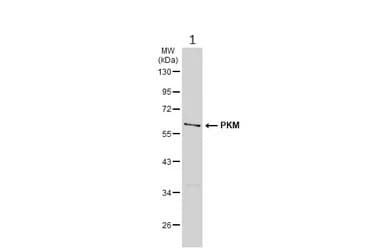 Pkm Antibody Ab137852  Western Blot Img449704