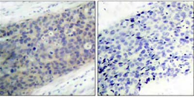 Limk2 Phospho T505 Antibody Ab38499  Immunohistochemistry Formalin Pfa Fixed Paraffin Embedded Sections Img110156