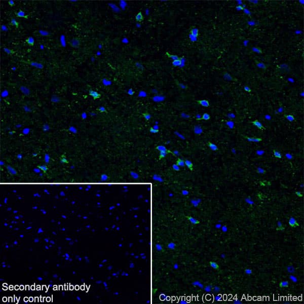 Anti-Nogo A + Nogo D antibody [EPR26286-15] - BSA and Azide free(AB318265)